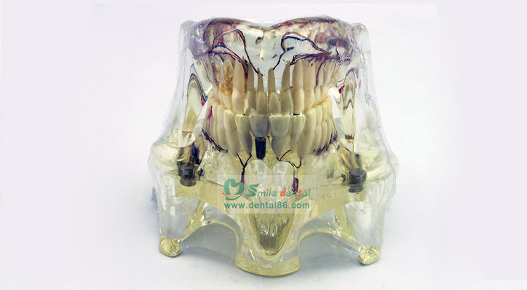 TM-C13 Pathology Model with nerves